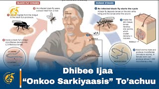 Dhibee Ijaa Onkoo Sarkiyaasis Toachuu