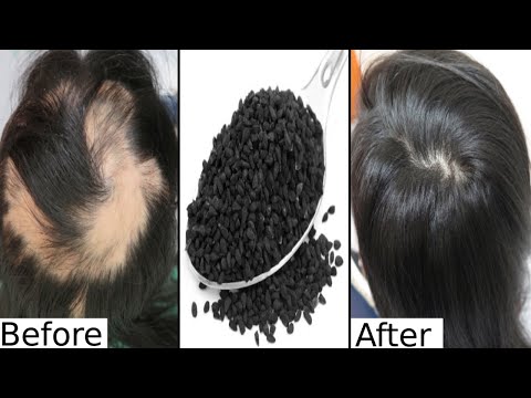 Video: Kaip Paspartinti Plaukų Augimą: 8 Paslaptys