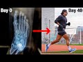 How i started running 6 weeks after breaking my foot