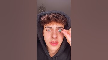 Kyle Thomas 💙 MY CONTACT LENS IS STUCK HELP #kylethomas #shorts