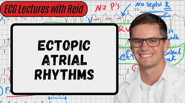 Ectopic Atrial Rhythms | Day 10 ECG Challenge
