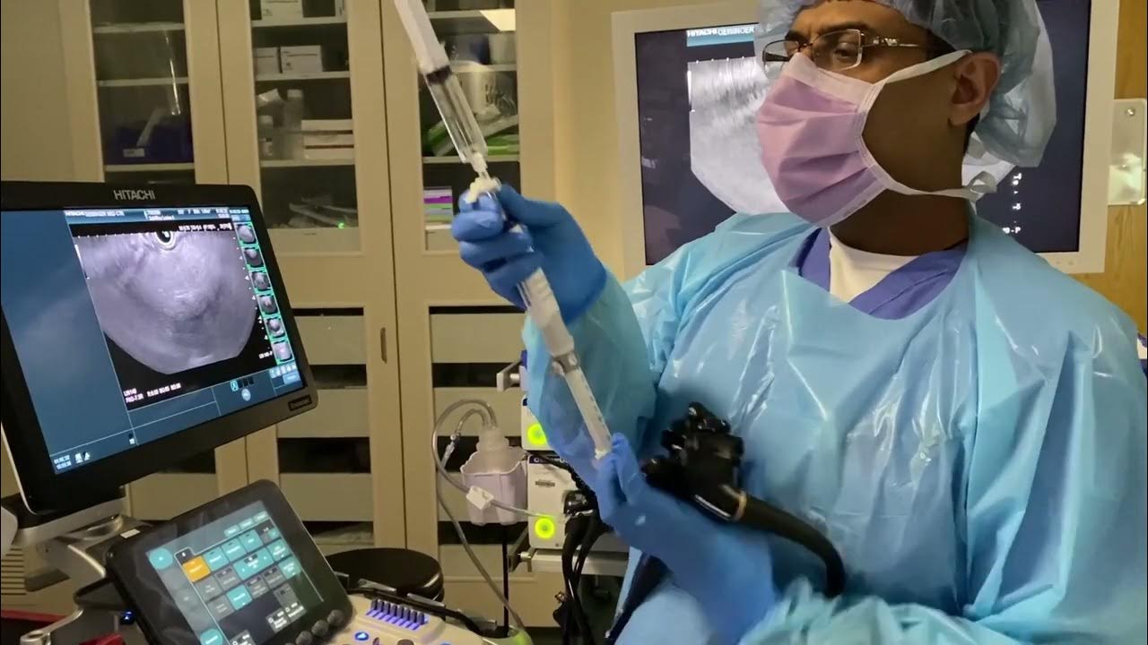 EUSGuided Liver Biopsy using EZ ShotTM 3 Plus Needle YouTube