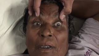 Opsoclonus Post Infectious, Dept. Of Medicine, Jnmc.