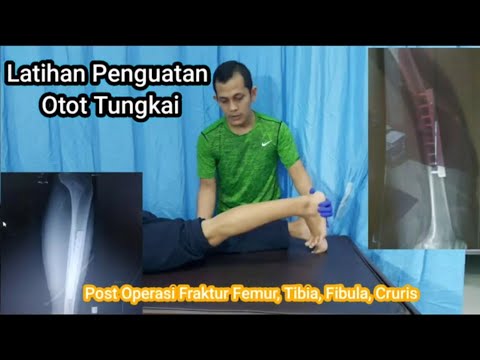 tutorial latihan dasar pasca operasi || fraktur femur || fraktur tibia fibula || kruris