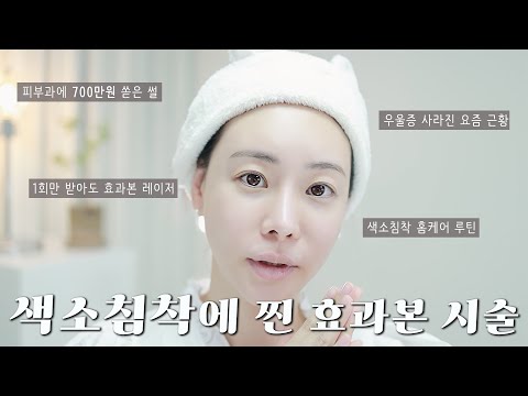 <strong>피부과</strong> 700만원넘게 쓰고 <strong>효과</strong> 본 찐 색소침착 <strong>레이저</strong> 후기와 함께 홈케어 할래요? / 색소침착홈케어루틴/피코토닝레이저/로즈픽스 Rosefix