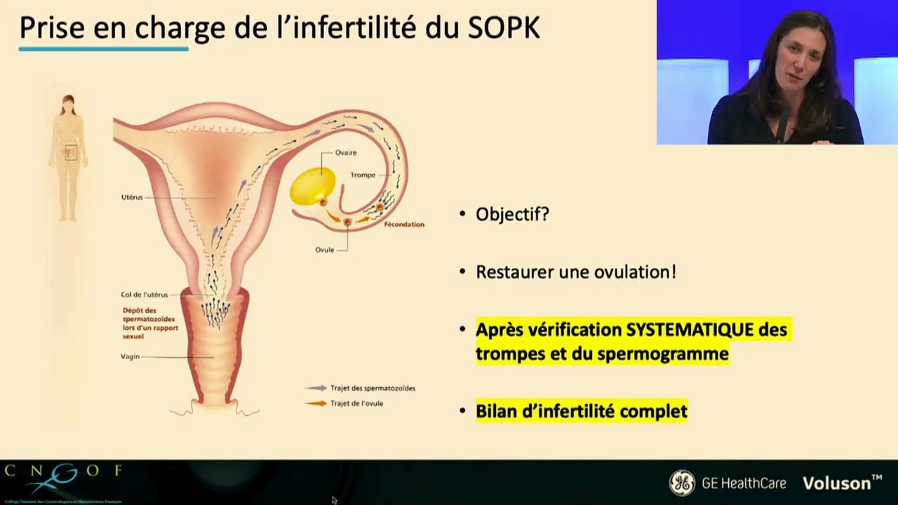 Webinar GE-CNGOF : SOPK   10-09-2024