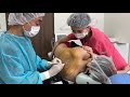 他の美容外科のナースさんの二の腕の皮下脂肪を根こそぐ！