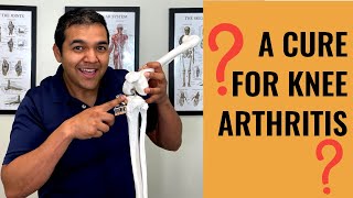Can Knee Arthritis Be Cured [What Doctors CAN’T Tell You]