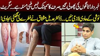 Varicose Veins in Legs | Hidden Health Risk Alert | Dr. Adeel Mushtaq Warning | NEO News