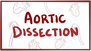 Aortic Dissection - causes, symptoms, diagnosis, treatment, pathology