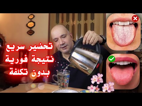 فيديو: كيفية ارتداء الحفاضات: 14 خطوة (بالصور)