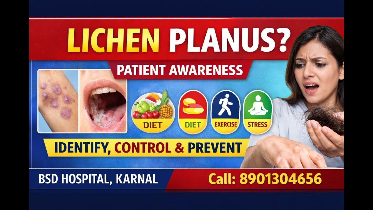 LICHEN PLANUS लाइकेन प्लेनस को समझना