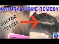 Hair loss in Teenagers | Increase hair volume naturally home remedy | 5 proven ways [Boys & Girls]