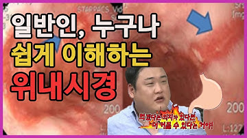 위내시경 동영상 설명! 위암 위용종 궤양 식도염 조직검사 수면 비수면?? 일반인도 이해하기 쉽게 알려드립니다!