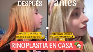 😱RESPINGA TU NARIZ SIN RINOPLASTIA NI TRATAMOS ESTETICOS desde casa 🏠