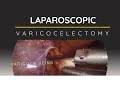 Laparoscopic varicocelectomy