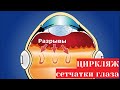 Циркляж сетчатки глаза с пломбированием - операция при разрыве и отслойке и её осложнения