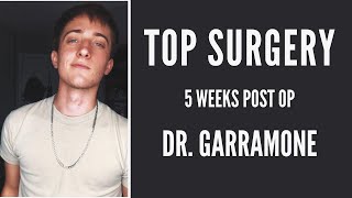 MY TOP SURGERY EXPERIENCE (Dr. Garramone) by Hayden Ezra 3,970 views 3 years ago 10 minutes, 43 seconds