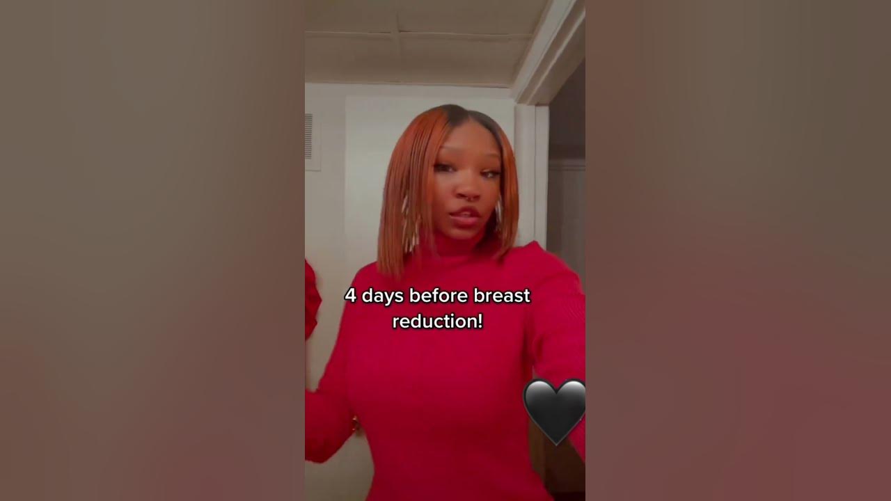 my-full-experience-on-the-day-of-surgery-is-on-my-channel-be-sure-to