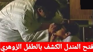 فتح المندل الكشف بالطفل الزوهري