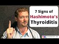 HASHIMOTO'S THYROIDITIS (7 Secret Signs You Should Know) 2021