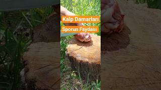 Kalp damarları,koroner damar kadavra otopsisi #kadavra #otopsi
