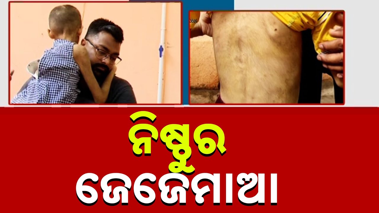 Cruelty Beyond Imagination: Grandmother Tortures Grandkids In Bhubaneswar