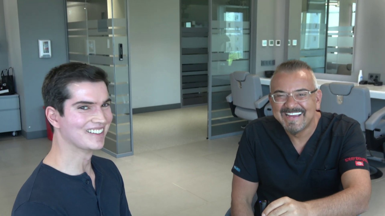 Результат пересадки волос методом FUE  4510 графтов