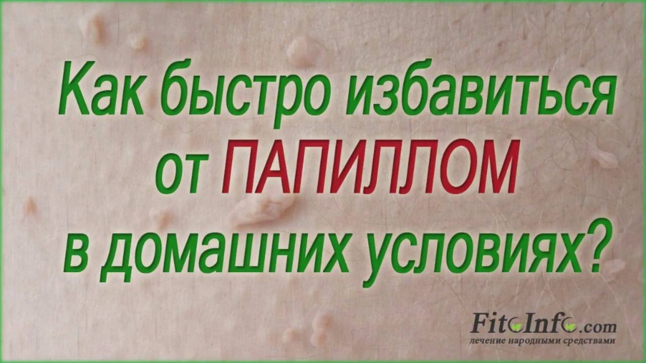 Как избавиться от ПАПИЛЛОМ быстро? Эффективные народные средства