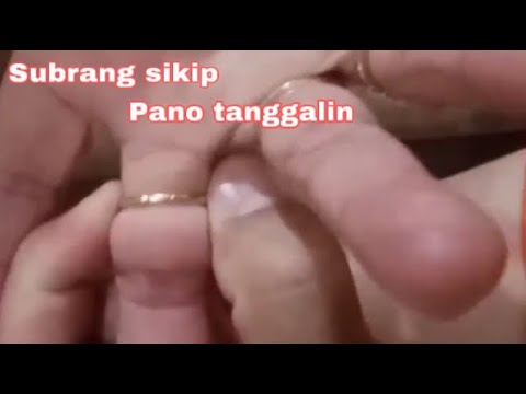 Video: 3 Mga paraan upang Alisin ang isang Singsing sa isang Emergency