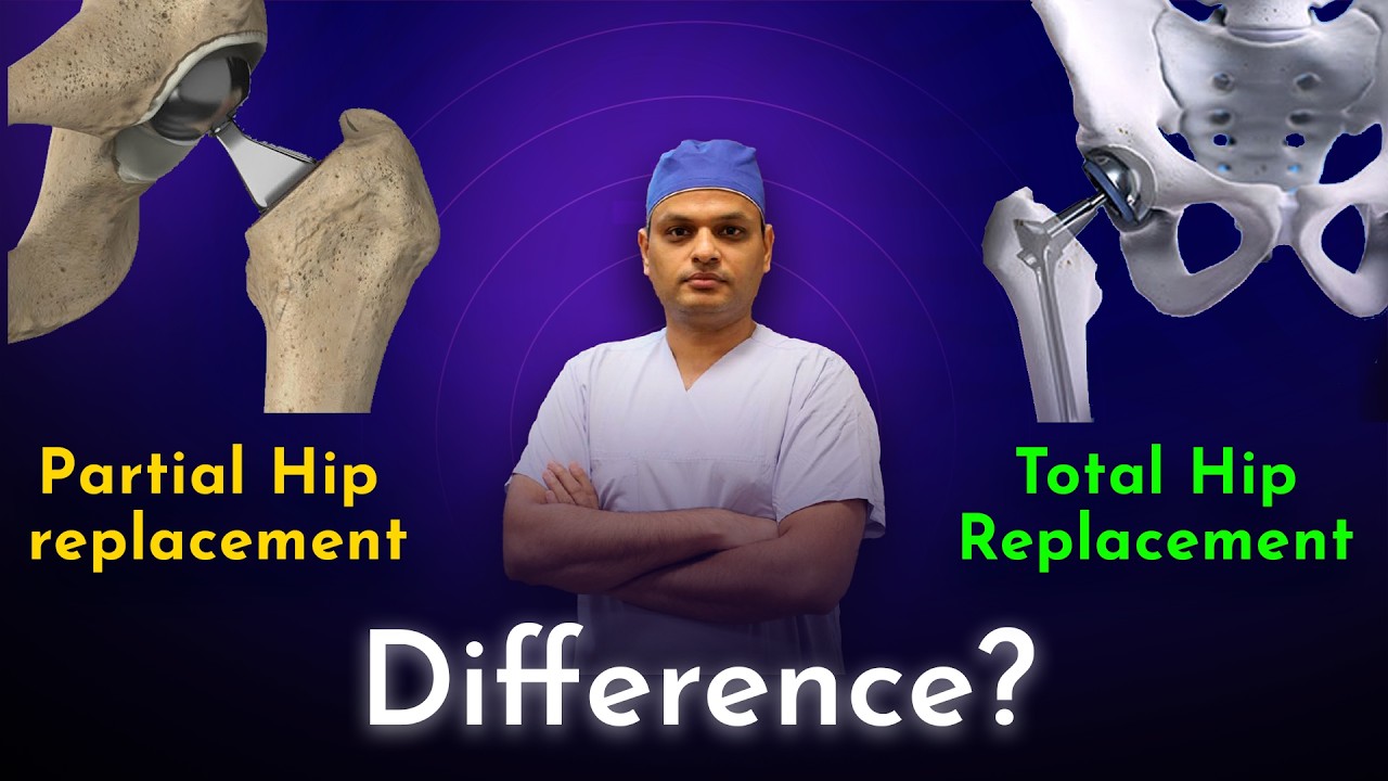 Surgeon Explains Total Hip Replacement vs partial Hip replacement | Hip ...