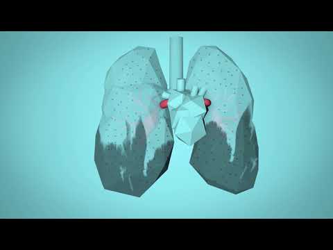 Video: Air Pollution - One Of The Causes Of Deaths Around The World - Alternative View