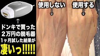 毛深くて悩んでる方はどうぞご覧ください。