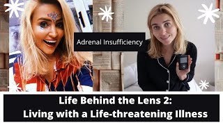 NEW: My Lifethreatening Condition Explained | Adrenal Insufficiency