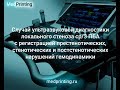 Атеросклероз, локальный стеноз ПБА 75-90% с нарушениями гемодинамики