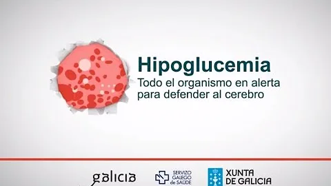 ¿Es la sudoración un síntoma de hiperglucemia?