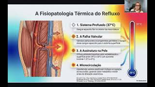termografia no mapeamento venoso