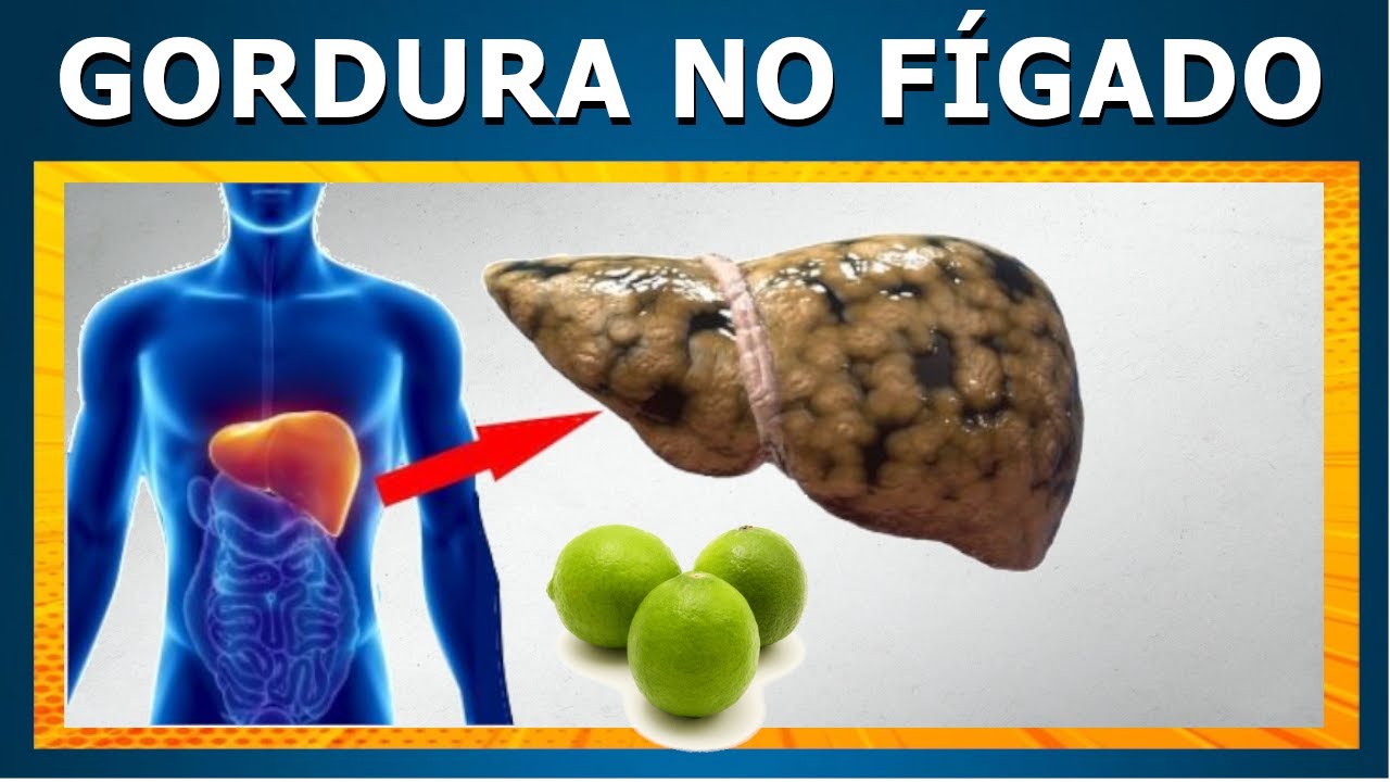 Como Eliminar Gordura No Figado Rapido
