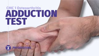 Celebrity Adduction Test | CMC 1 Osteoarthritis Wealth