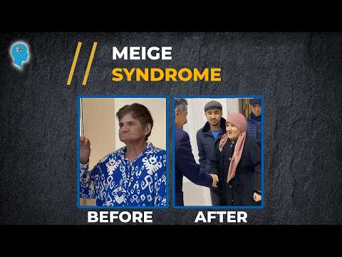 From Uzbekistan to Turkey: A Promising Step in the Fight Against Meige Syndrome