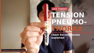 Tension Pneumothorax | Chest Decompression Explained