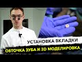 Коронка вкладка на зуб CEREC и профессиональная чистка зубов за 3.5 часа #vitazahnfabrik Suprinity