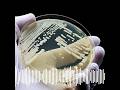 ''It is a little bit scary' Deadly infection spreads in US hospitals