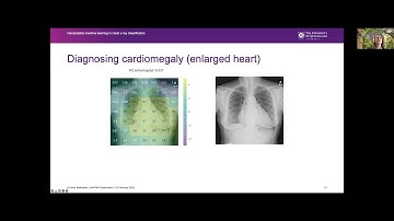 AI4Pandemics Talk #15: Interpretable machine learning Chest X-Ray, Alina Bialkowski. Feb 16, 2022.