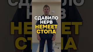 Сдавило Нерв Немеет Стопа