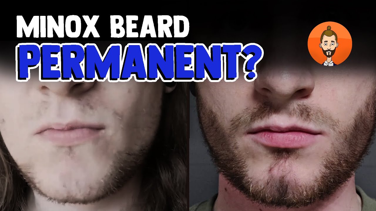 MINOX BEARD - Did I keep my minoxidil YouTube