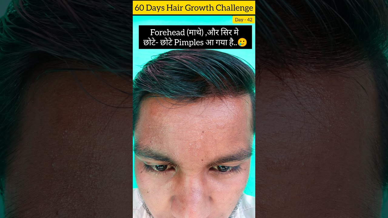 jamalgota side effects l🥵l Jamalgota seed side effects l jamalgotaforhairtreatment 
