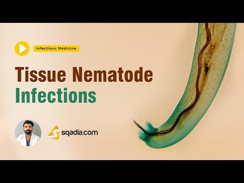 Tissue Nematode Infections | Medicine Lectures | Medical Student Online | V-Learning