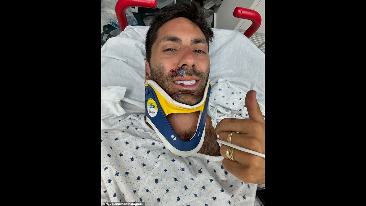 Terrifying accident: Nev Schulman breaks his neck