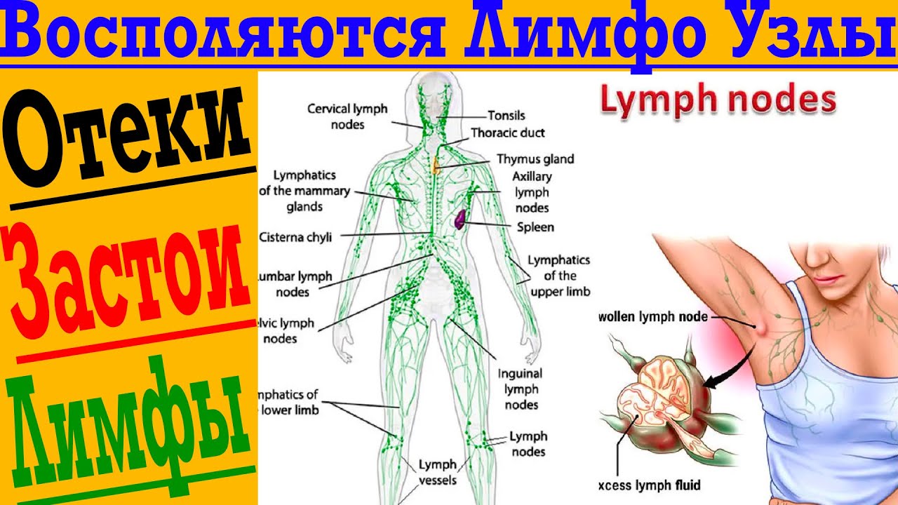 Почему у меня воспаляются ЛИМФОУЗЛЫ ?! - YouTube
